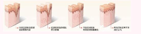 昆明華美美萊美容醫(yī)院黃夢婷祛痘方法