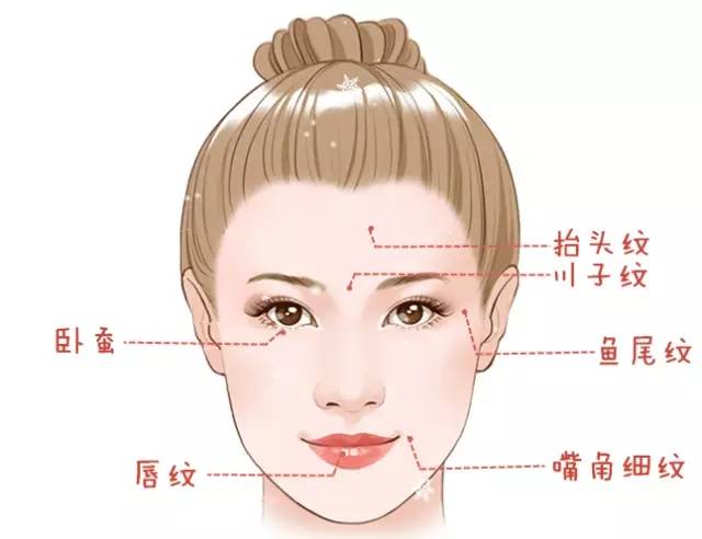 注射玻尿酸除皺手術(shù)后，需要注意哪些事項(xiàng)？