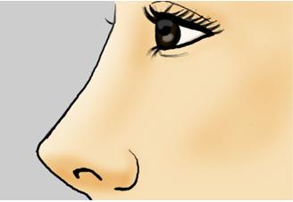 <a href='/cq/' target='_blank'><u>重慶美萊</u></a>玻尿酸隆鼻價格貴嗎？
