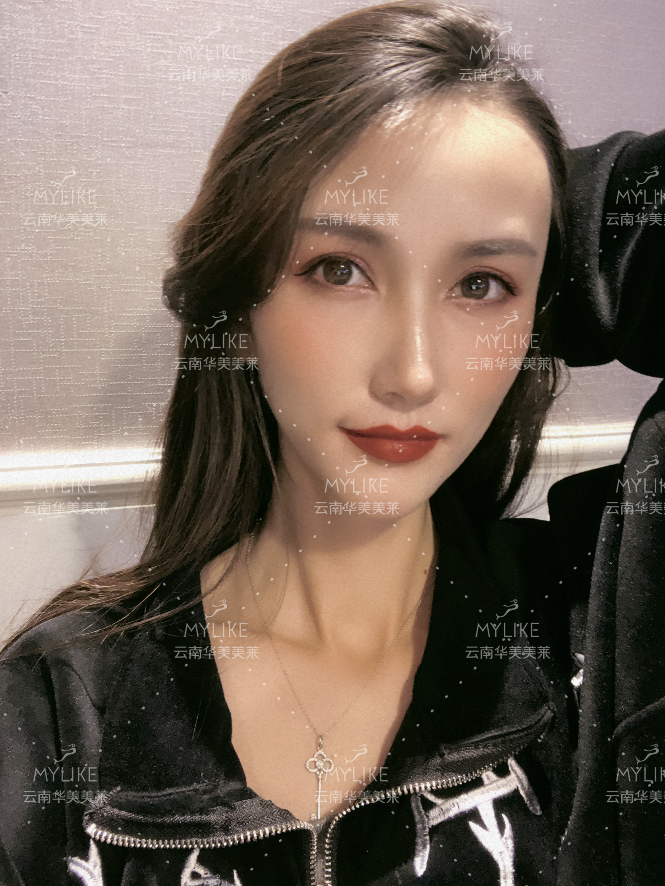 2018年“魅力絲路 時尚昆明”車模大賽勝者必要做的醫美項目??！美萊雙十一get好物推薦