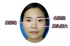 萬州做硅膠隆鼻術后硅膠能取出嗎