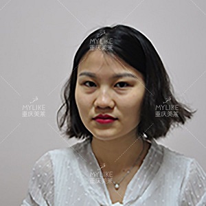 美萊案例Jeffrey對(duì)比圖后