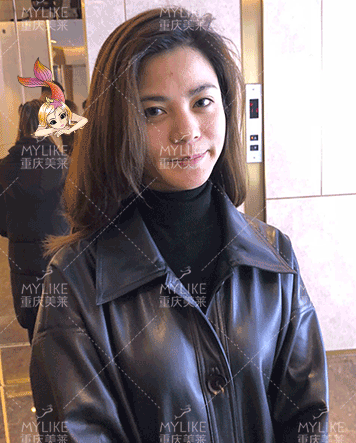 美萊案例星星小主對(duì)比圖后
