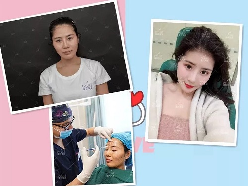 開搶丨重慶美萊多款項(xiàng)目2折起，玻尿酸、玻尿酸、抽脂針任性抽！