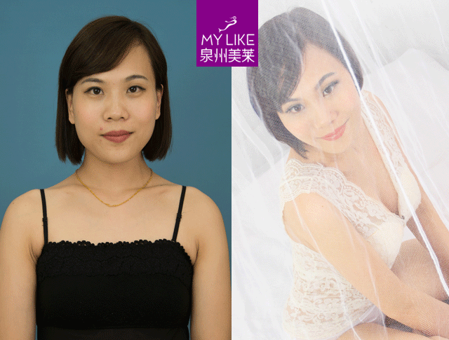 泉州美萊說：喂完下一代，酥胸變布袋？怎么解決
