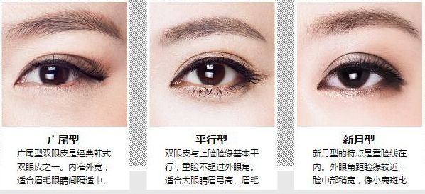 寧波做雙眼皮手術(shù)后眼睛腫脹怎么辦？