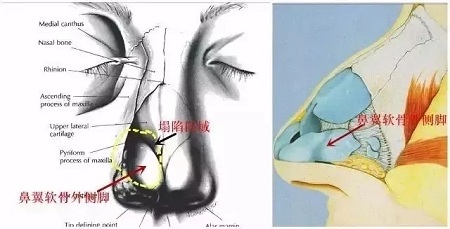 『雙側耳軟骨鏡像移植』男友“捏鼻殺”是什么感覺？