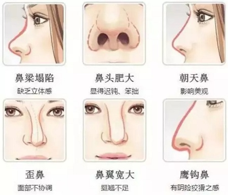 鼻子問題？！過年“萊”轉(zhuǎn)運(yùn)~