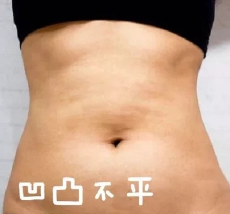 這個冬天，我“脂”在乎你，就來美萊吧