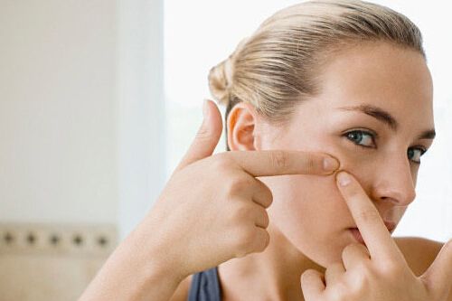 激光去痘后怎么護理？