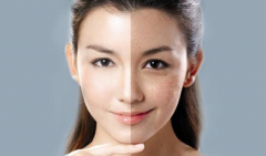 光子嫩膚價格是多少？