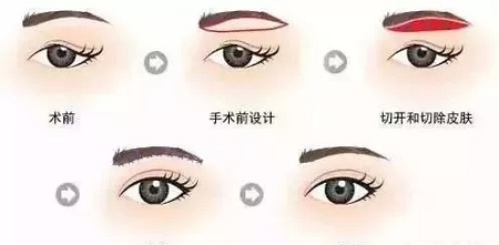 眼部衰老的三大“殺手”！