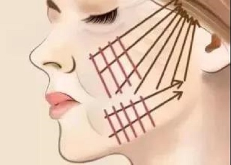 圍觀| 僅靠一條線，如何提升你的下垂臉？！