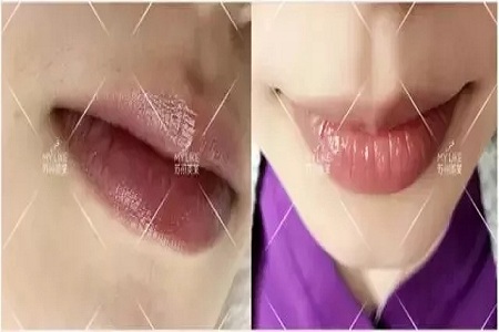 想過嗎？為啥有人的體毛多有的人少？