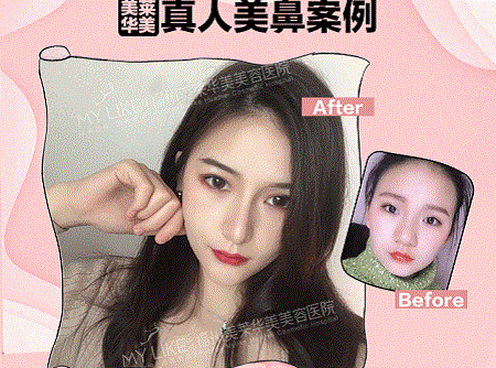她曾丑到無人問津，現在卻擁有魔鬼身材，簡直是“行走的美人魚”