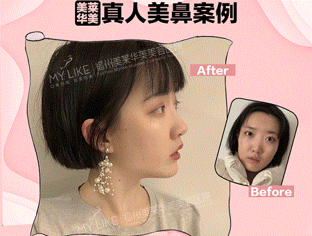 現在卻擁有魔鬼身材，簡直是“行走的美人魚”