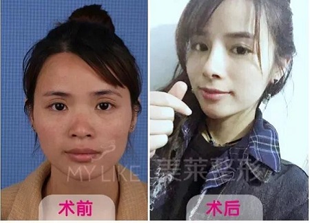 長著一張“大媽臉”的她，卻比喬妹還能收割男神？！