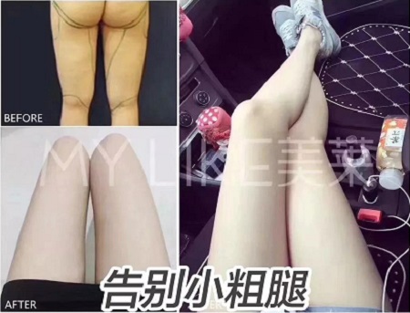 簡單幾招瘦小肚子，火速收藏！