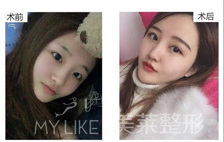 美萊特邀整形醫(yī)師—卜勝利主任，3月4日親診石家莊美萊。
