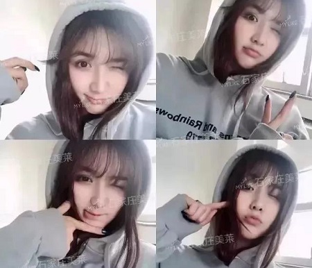 脂肪填充1周后，小喪臉竟嫩過少女！