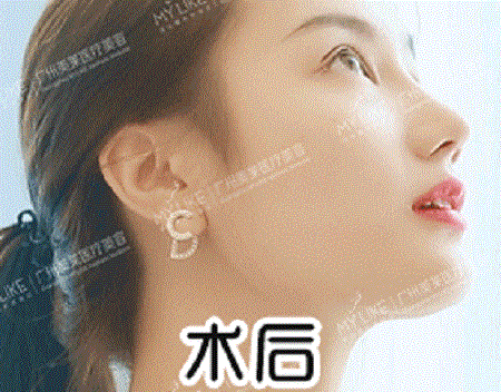  你與仙女只差一個鼻子的距離！