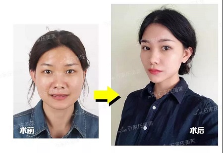 她們的眼睛做的，男神都會多看幾眼！