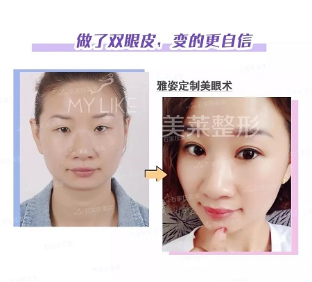 注意啦！這些眼睛一點都不招人喜歡！