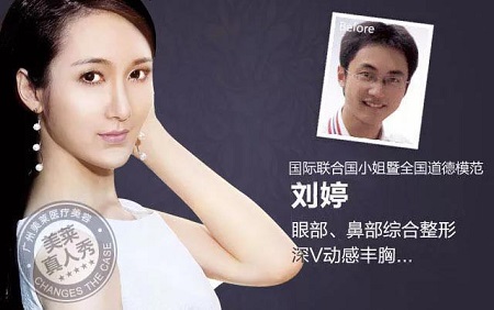  23-24日，韓國(guó)較會(huì)整容的柳元敏博士，來了！