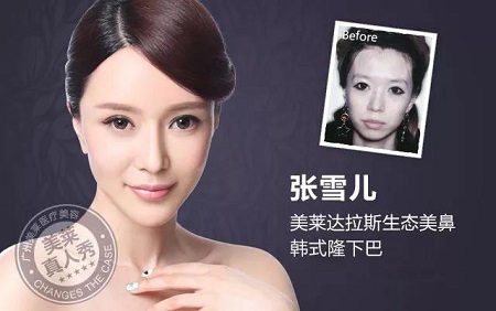  23-24日，韓國(guó)較會(huì)整容的柳元敏博士，來了！