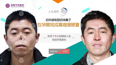 【真人秀】別再問隆鼻難不難做，沒有鼻子都能變出來！