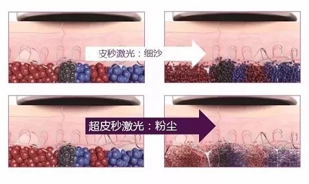 關于祛斑，可不能用美圖秀秀、輕顏相機、無他相機麻痹自己！