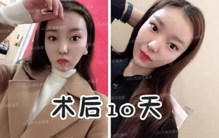 天天喊著要減肥！減肥！但，你真的胖嗎？