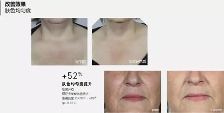 抗衰老的“水光”究竟為何飽受稱贊？