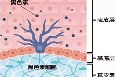 祛斑偏方“害死人”，小仙女們可長點心吧！
