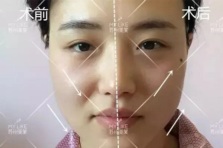 沒(méi)有誰(shuí)能永遠(yuǎn)年輕，不老都是保養(yǎng)的早！