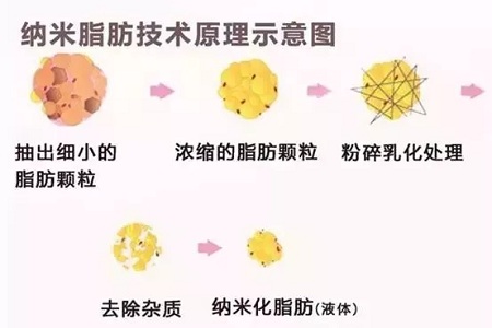 拿什么拯救你，我的黑眼圈？