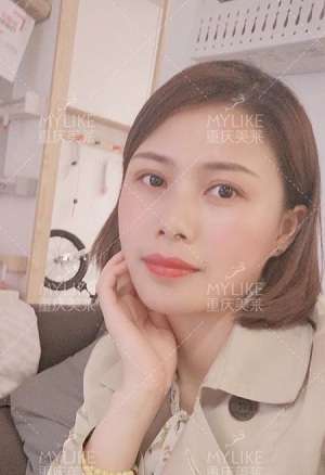 讓明星“一夜回春”的自體脂肪到底適不適合你？