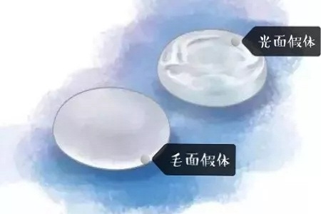 【漲知識(shí)】 解讀你較關(guān)心的假體隆胸問題!