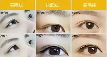 美瞳線(xiàn)