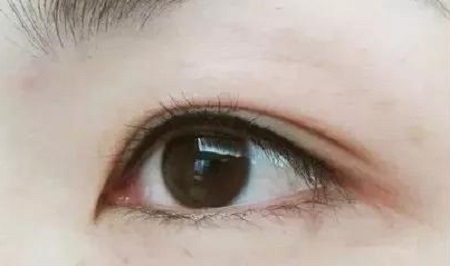 美瞳線(xiàn)