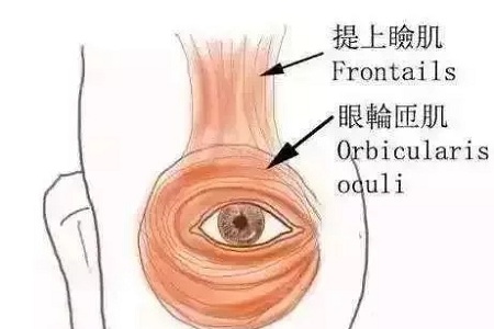 做了雙眼皮，醫(yī)師為什么建議要多睜眼？