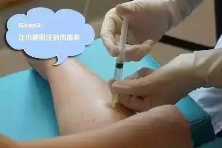 這有一個快速又持久瘦小腿的方法！請注意查收！