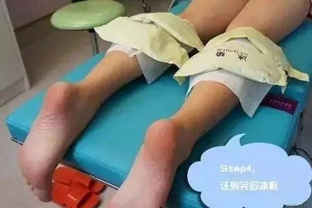 這有一個快速又持久瘦小腿的方法！請注意查收！