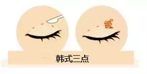 雙眼皮我想做埋線，為什么醫師建議我做全切雙眼皮