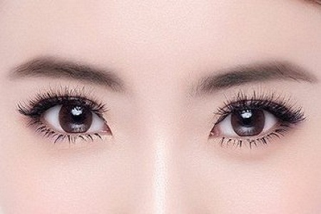 雙眼皮我想做埋線，為什么醫師建議我做全切雙眼皮