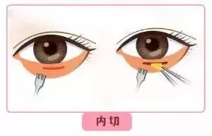 每到放假，做這個項目的人就會增多！--眼袋