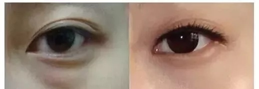 每到放假，做這個項目的人就會增多！--眼袋