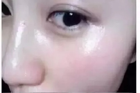 水光，打1次和4次究竟有多大區別？