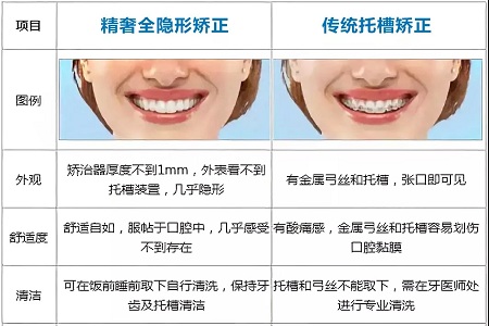 這種牙齒矯正方式，96%的人都會(huì)選擇！