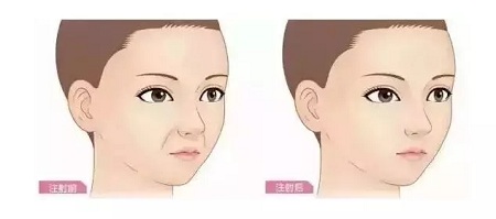 問診室：你說(shuō)脂肪壓得你好累，殊不知它也可以是寶貝